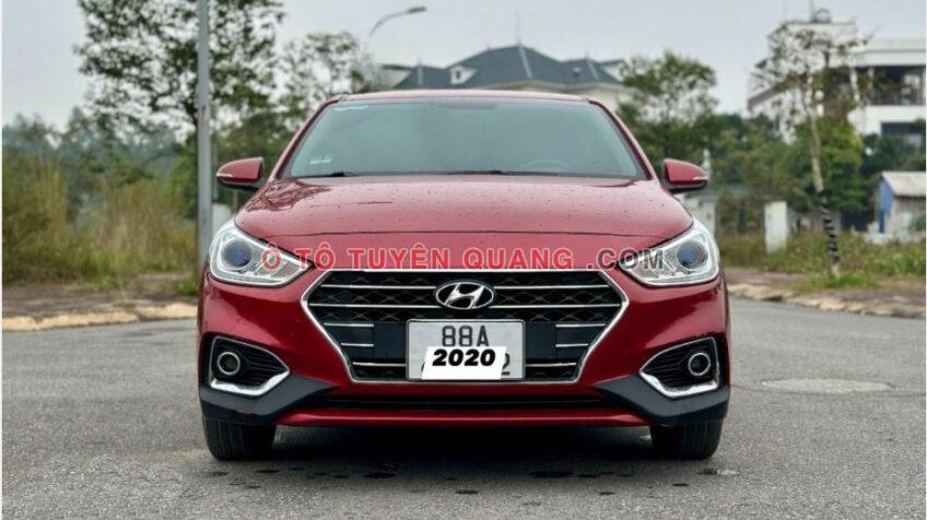 Xe Hyundai Accent 1.4 MT 2020 – 385 Triệu